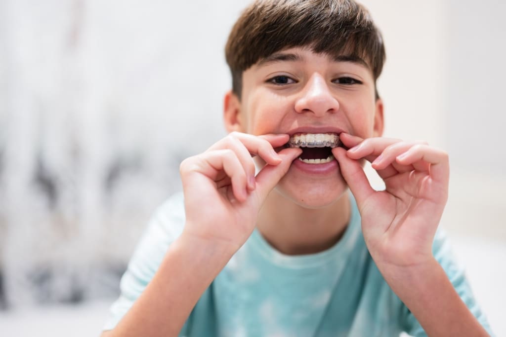 Parent’s Guide to Teen Invisalign Treatment