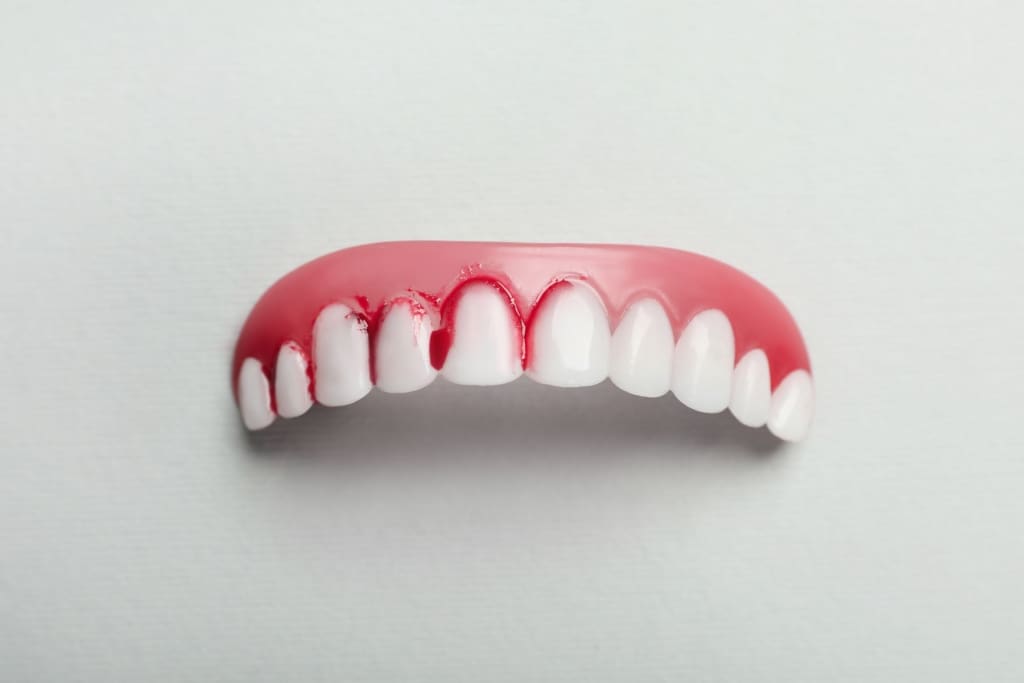 How Long Can You Keep Your Teeth with Periodontal Disease?