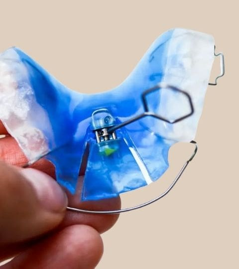 removable braces