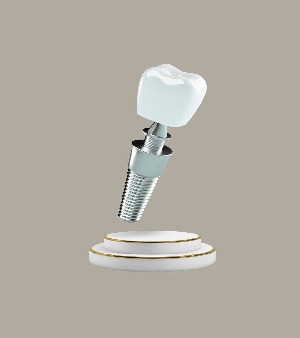 single implant